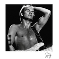 Sting